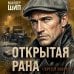Открытая рана