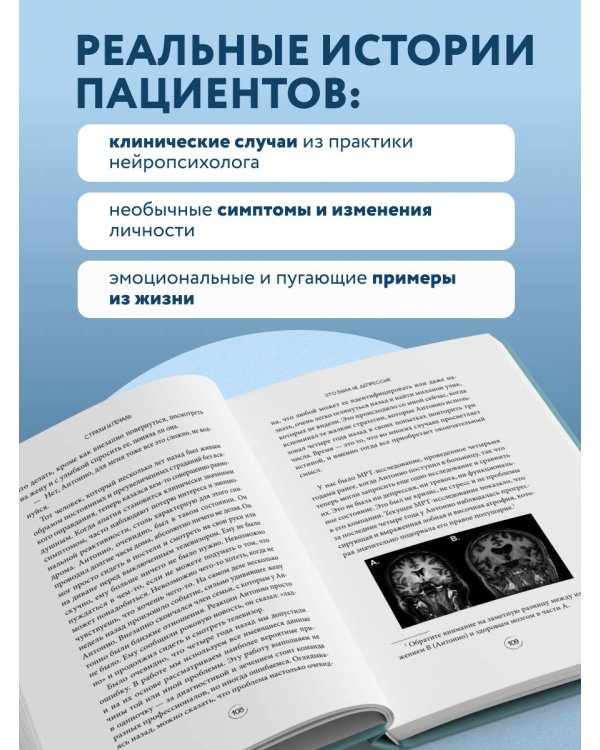 Хрупкий разум. Нейропсихолог о том, какие сбои происходят в мозге и как это меняет личность человека