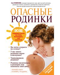 Опасные родинки