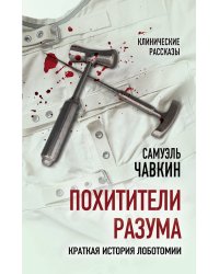 Похитители разума. Краткая история лоботомии