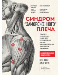 Синдром «замороженного» плеча. Терапия триггерных точек для преодоления боли и восстановления диапазона движений