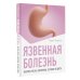 Азбука здоровья. Практикум Язвенная болезнь. Факторы риска, симптомы, лечение и диета