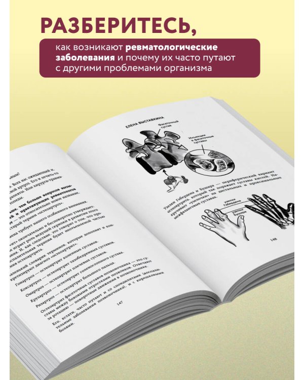 Ревматология по полочкам. Сопутствующие болезни, осложнения и запутанные случаи