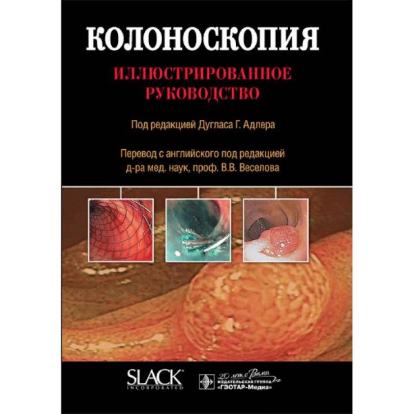 Колоноскопия.Иллюстрированное руководство