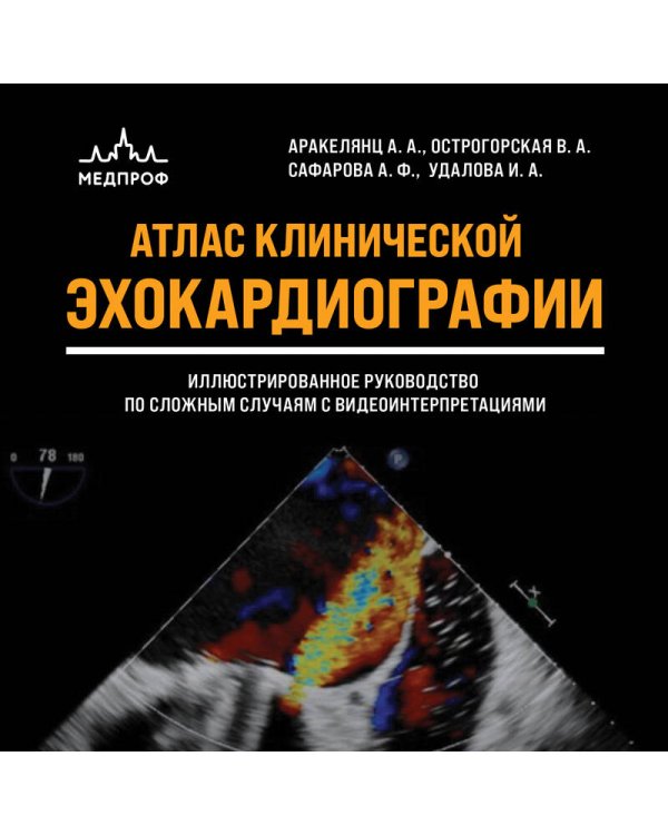 Дополнительное изображение книги «Атлас ЭхоКГ. Иллюстрированное руководство по сложным случаям с видеоинтерпретациями»