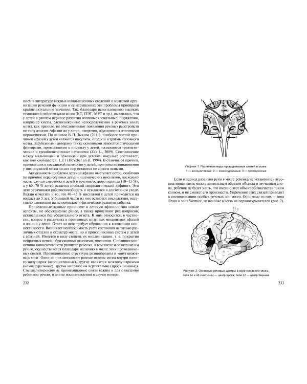 Коррекция речи у дошкольников. Логопедия: дошкольное детство