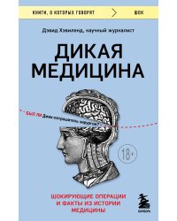 Дикая медицина. Шокирующие операции и факты из истории медицины