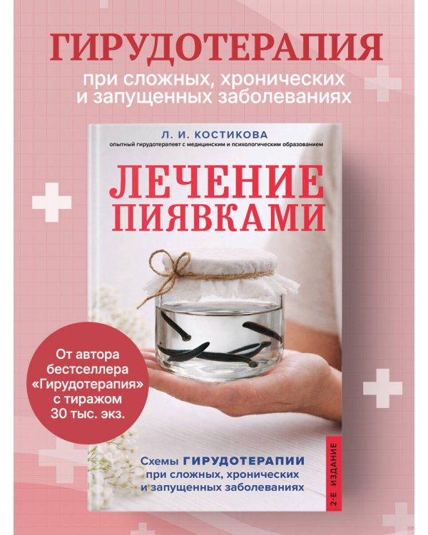 Лечение пиявками. Схемы гирудотерапии при сложных, хронических и запущенных заболеваниях