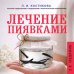 Лечение пиявками. Схемы гирудотерапии при сложных, хронических и запущенных заболеваниях