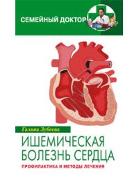 Ишемическая болезнь сердца Профилактика и лечение