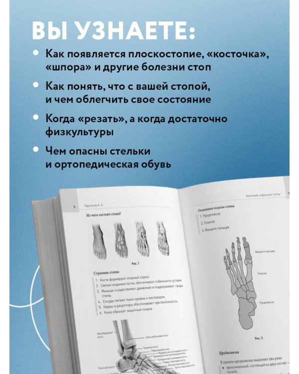 Стопы без боли. Все о плоскостопии, косточках и не только