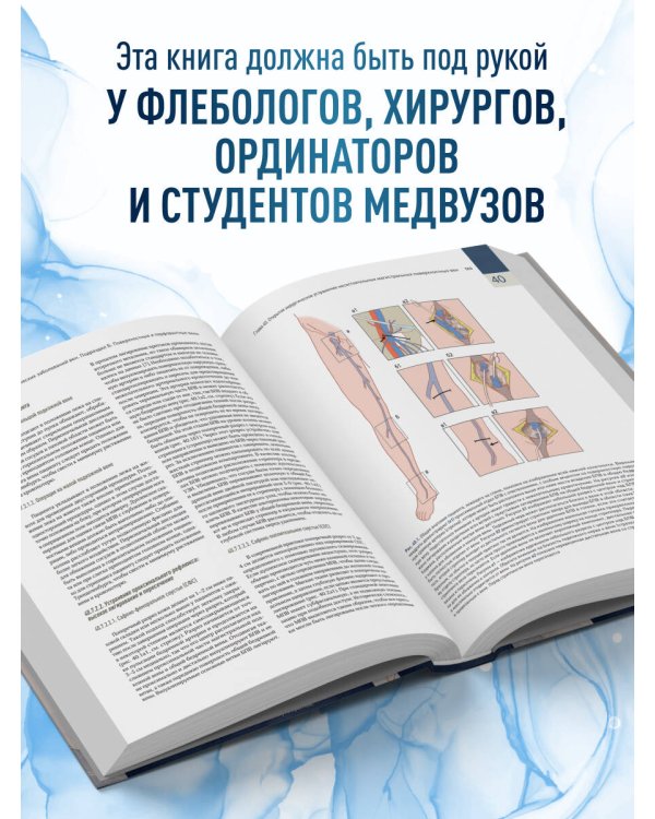 Дополнительное изображение книги «Венозные и лимфатические заболевания. Практическое руководство, 5-е издание»