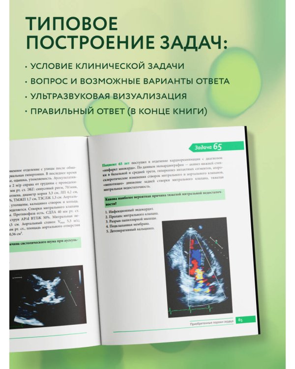 Клинические задачи по эхокардиографии