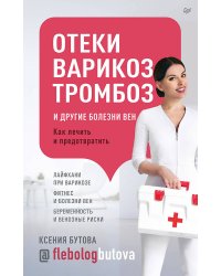Отеки, варикоз, тромбоз и другие болезни вен. Как лечить и предотвратить