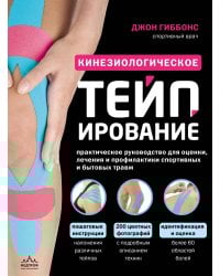 Кинезиологическое тейпирование