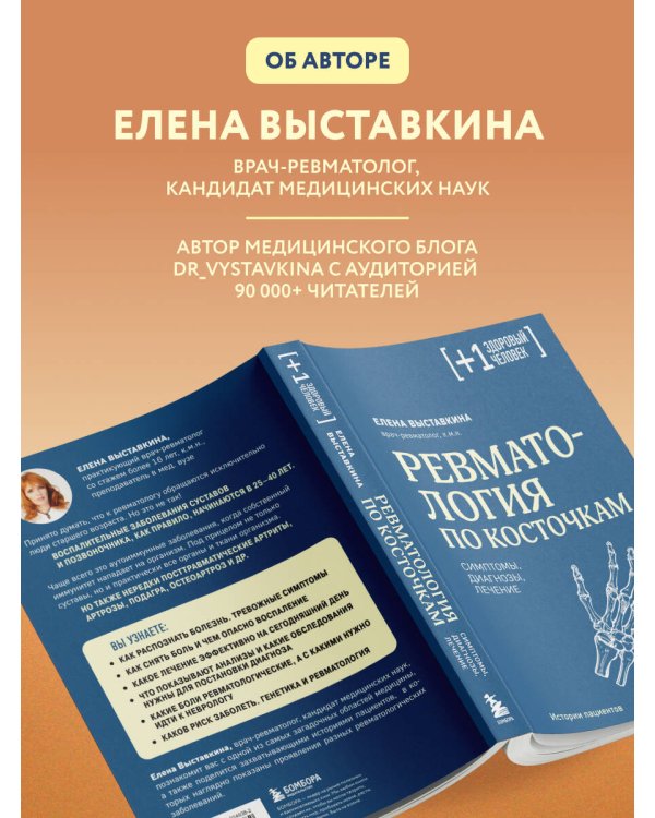 Ревматология по косточкам. Симптомы, диагнозы, лечение