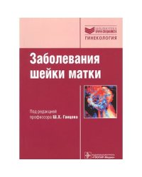 Заболевания шейки матки