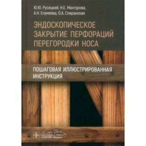 Эндоскопическое закрытие перфораций перегородки носа.Пошаговая иллюстриров.инструкция