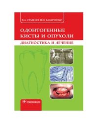 Одонтогенные кисты и опухоли (диагностика и лечение)