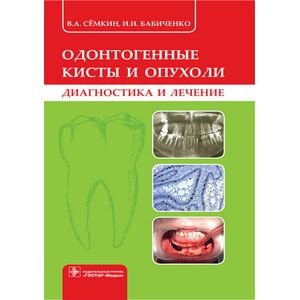 Одонтогенные кисты и опухоли (диагностика и лечение)