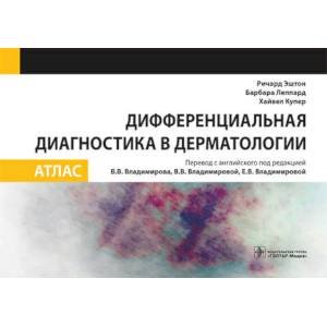 Дифференциальная диагностика в дерматологии