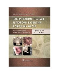 Заболевания,травмы и пороки развития слюнных желёз