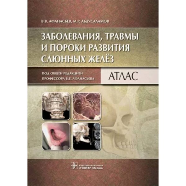 Заболевания,травмы и пороки развития слюнных желёз