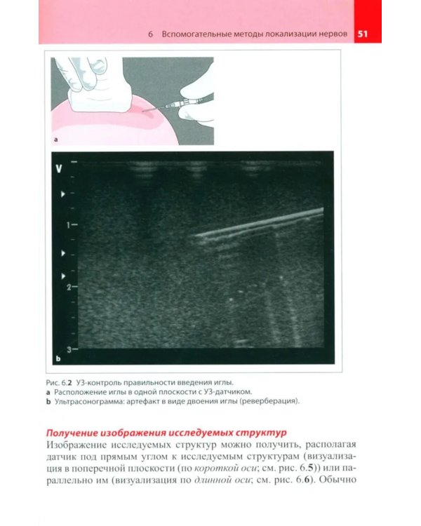 Блокады периферических нервов. 4-е изд