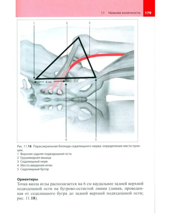 Блокады периферических нервов. 4-е изд