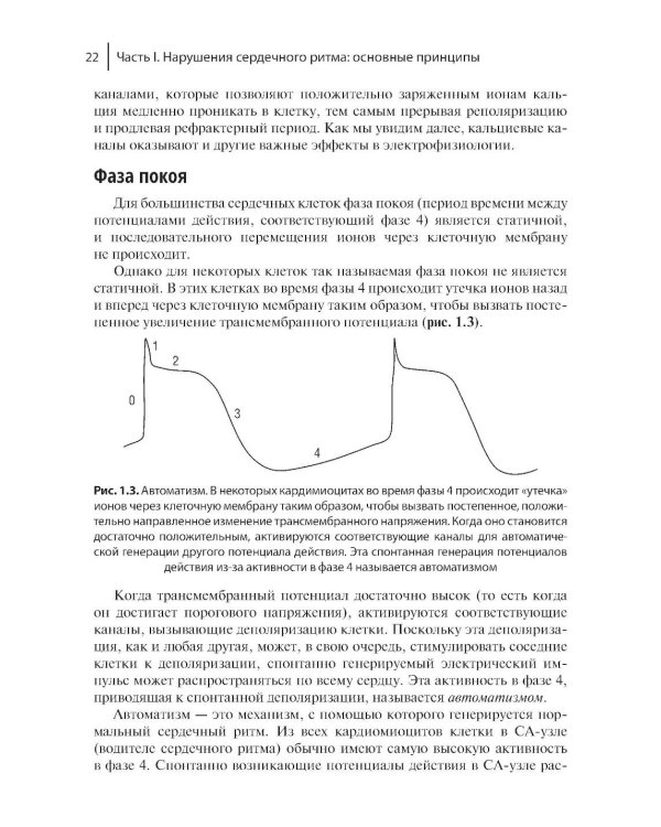 Электрофизиологическое исследование в кардиологии по Фогоросу