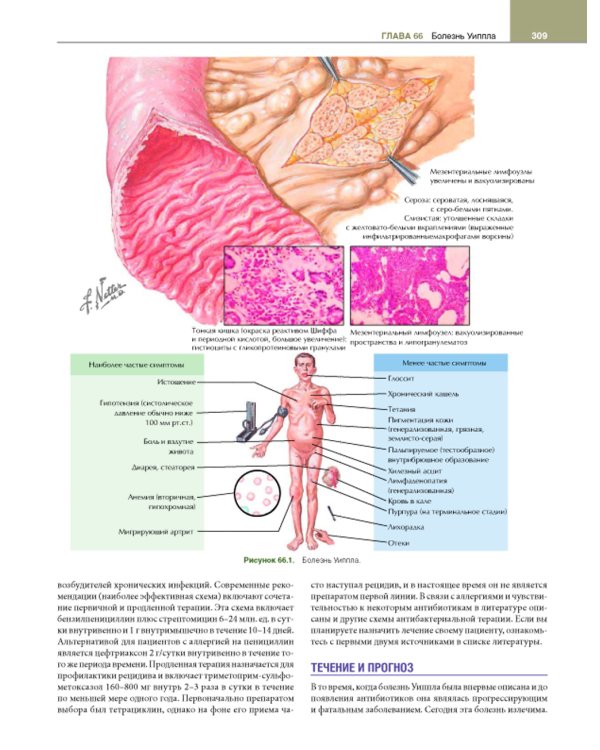 Гастроэнтерология с иллюстрациями Неттера. В 2 ч. (комплект из 2 кн.)