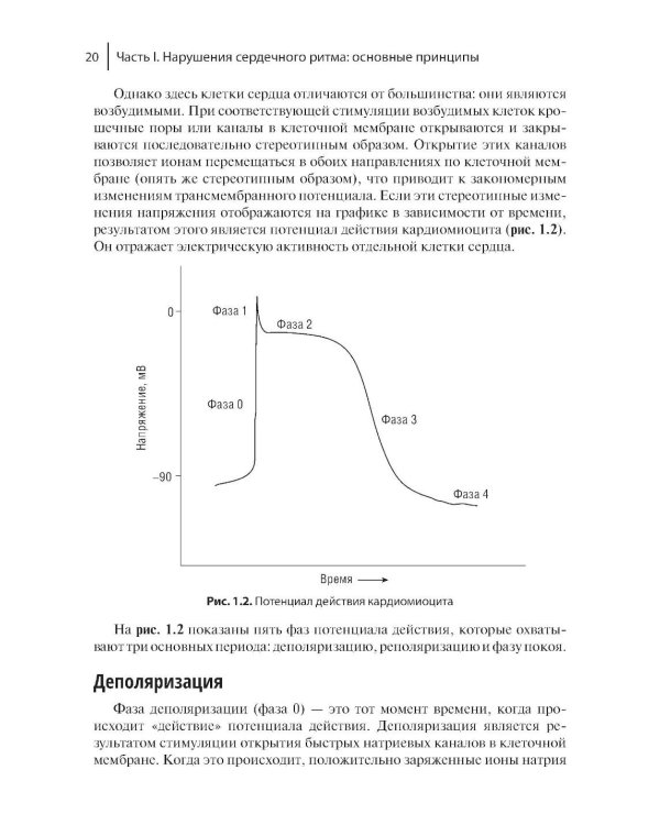 Электрофизиологическое исследование в кардиологии по Фогоросу