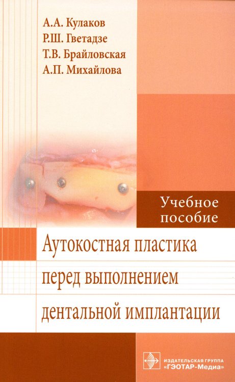 Аутокостная пластика перед выполнением дентальной имплантации: Учебное пособие Аутокостная пластика перед выполнением дентальной имплантации: Учебное пособие