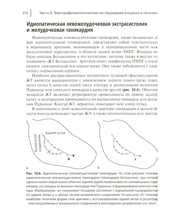 Электрофизиологическое исследование в кардиологии по Фогоросу