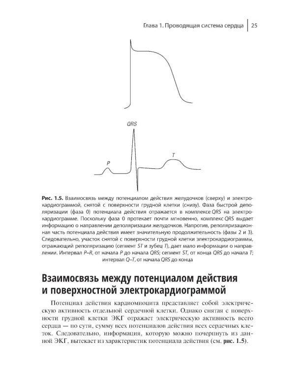 Электрофизиологическое исследование в кардиологии по Фогоросу