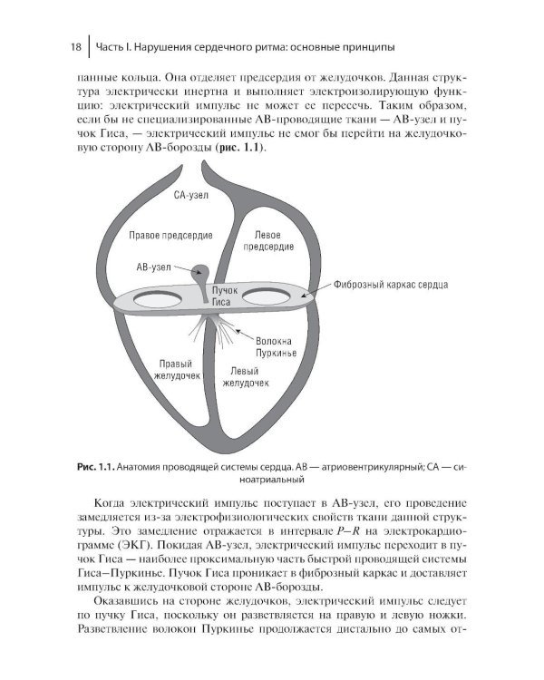 Электрофизиологическое исследование в кардиологии по Фогоросу