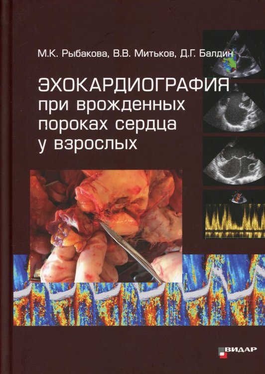 Эхокардиография при врожденных пороках сердца у взрослых Эхокардиография при врожденных пороках сердца у взрослых
