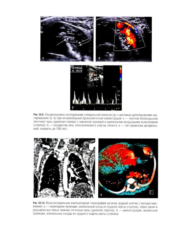 Неонатология. Национальное руководство: В 2 т. (комплект)
