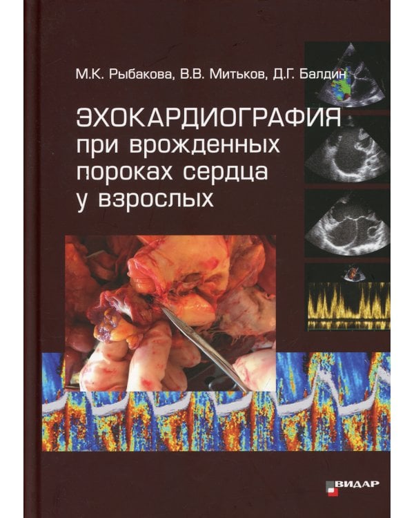 Эхокардиография при врожденных пороках сердца у взрослых