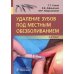"Удаление зубов под местным обезболиванием. Атлас