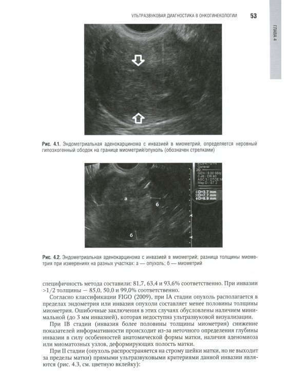 Онкогинекология: национальное руководство