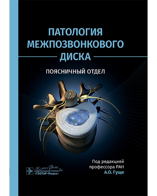 Патология межпозвонкового диска. Поясничный отдел