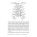 Послеоперационный стерномедиастинит. Комплексный подход к лечению Послеоперационный стерномедиастинит. Комплексный подход к лечению