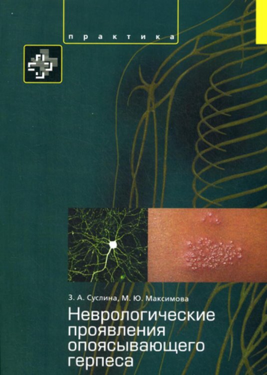 Неврологические проявления опоясывающего герпеса. Пособие для врачей Неврологические проявления опоясывающего герпеса. Пособие для врачей