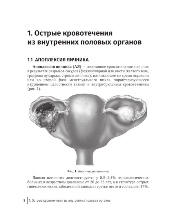 Острый живот в гинекологии: руководство для врачей