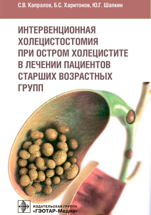 Интервенционная холецистостомия при остром холецистите в лечении пациентов старших возврастных групп