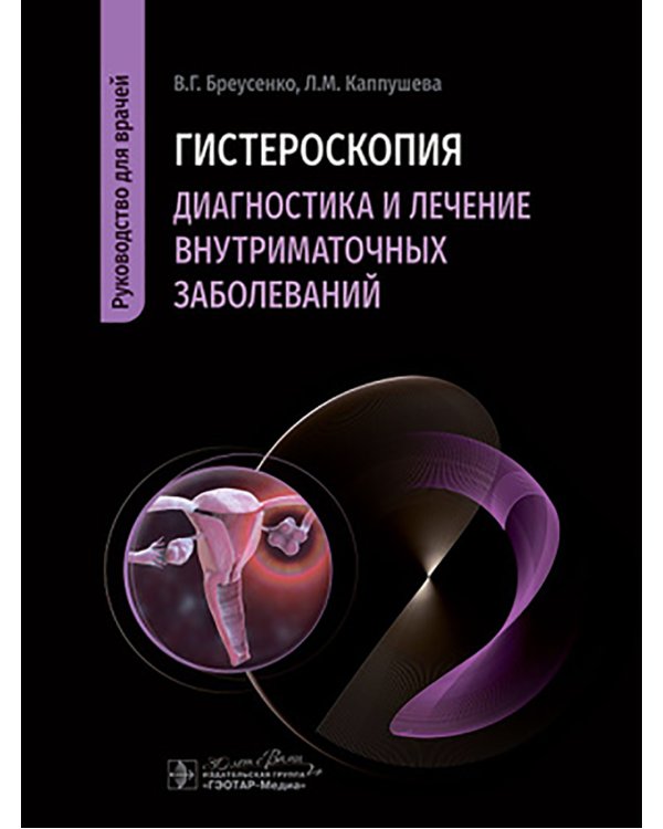 Гистероскопия. Диагностика и лечение внутриматочных заболеваний: руководство для врачей