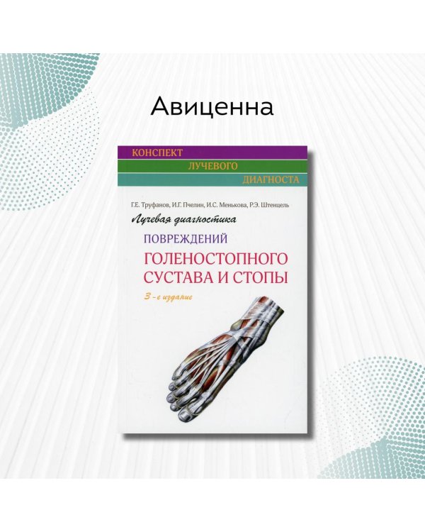Лучевая диагностика повреждений голеностопного сустава и стопы