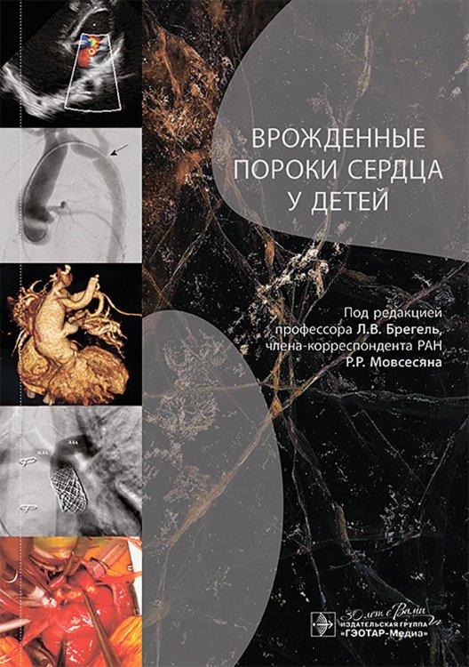 Врожденные пороки сердца у детей: руководство для врачей