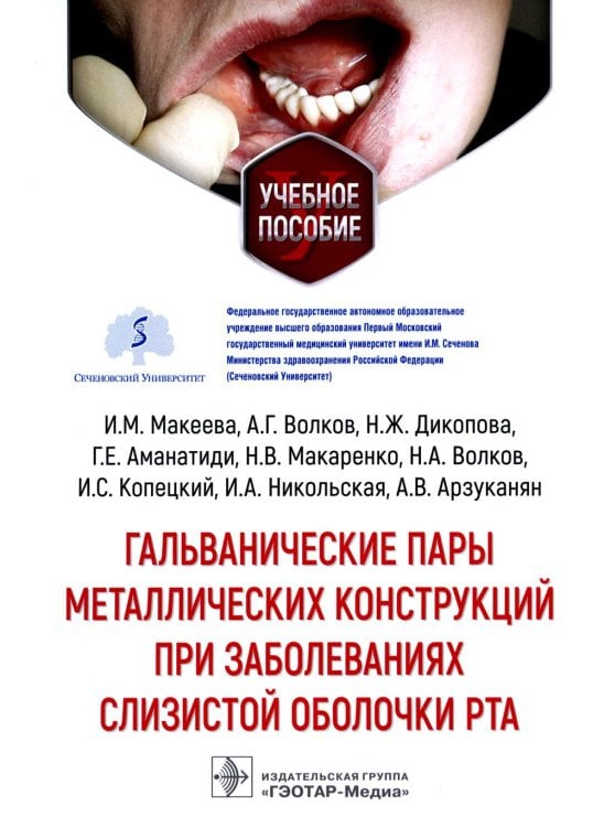 Гальванические пары металлических конструкций при заболеваниях слизистой оболочки рта: Учебное пособие Гальванические пары металлических конструкций при заболеваниях слизистой оболочки рта: Учебное пособие